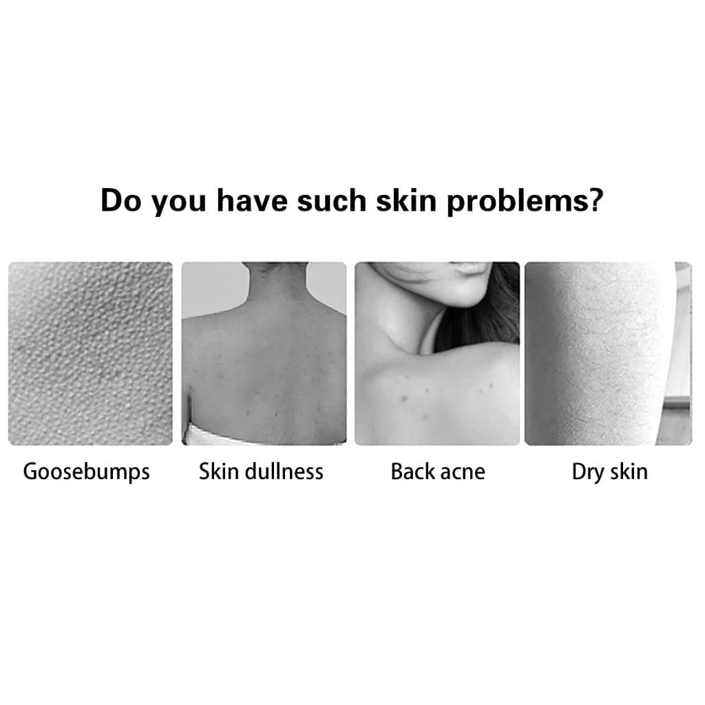 Image illustrating four common skin issues: goosebumps, skin dullness, back acne, and dry skin, each paired with a representative image. Text prompts, "Do you experience these skin problems?" Consider our Zen Fizzers - Rose Shower Steamers or Shower Bombs for relief.